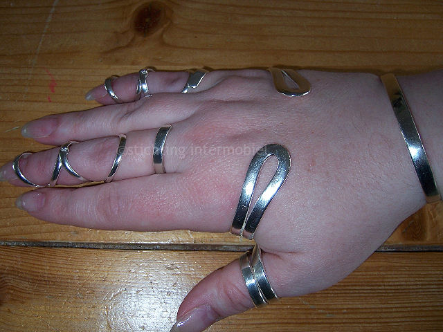 De hand van Daan met silversplints